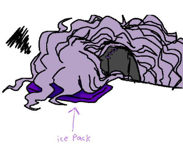 migraine